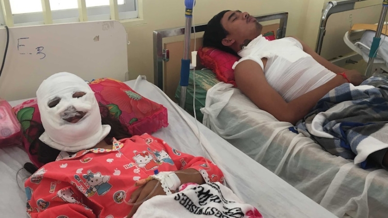 Acid attacks on Indonesian women prompt calls to tighten chemical sales