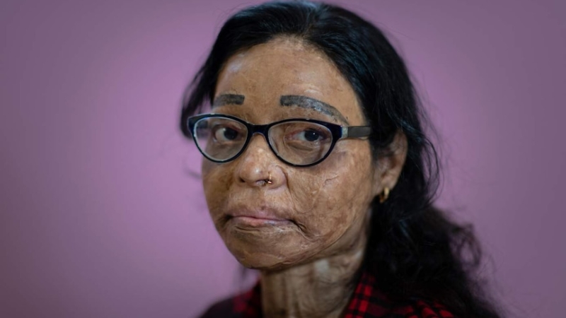 Acid attacks on Indonesian women prompt calls to tighten chemical sales